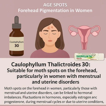 Caulophyllum 30: Targeting Forehead Pigmentation in Women. Natural Relief from Moth Spots Linked to Menstrual Imbalance