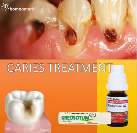 Homeopathy doctor highly recommends Kreosote (Kreosotum) 200 for treating caries in both children and adults