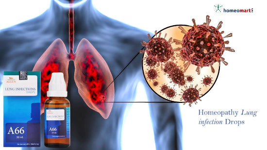 Homeopathy A66 drops  Supports Lung Health – Fights Pneumonia, Bronchitis, Pleural Effusion