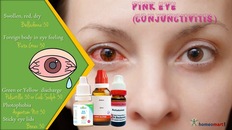 If you're having bacterial pink eye symptoms, the safest way to treat them is with homeopathy