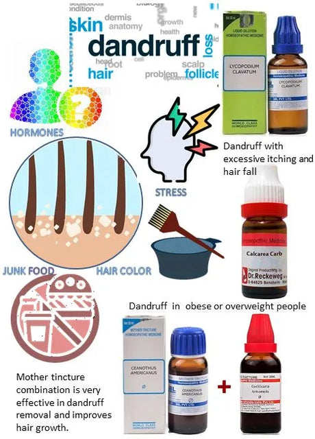 10 natural remedies for dandruff, safe and natural