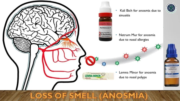 homeopathy medicines for loss of smell (anosmia)