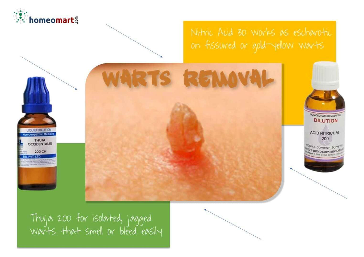 how to remove jagged warts