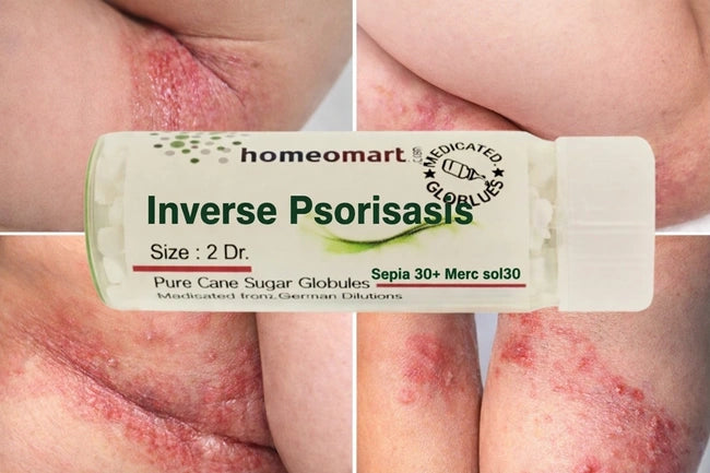 Homeopathic remedy for psoriasis with skin conditions shown on a person's body folds