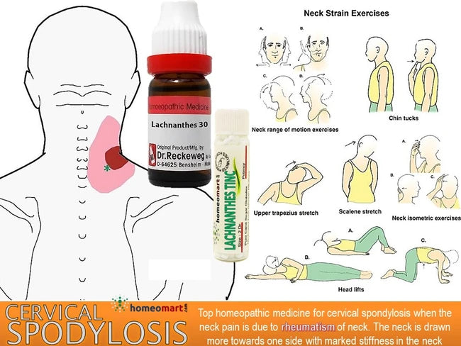 Lachnanthes 30 – For cervical pain or twisted neck or head drawn to one side, as if dislocated.