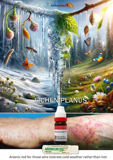 homeopathy Arsenicum Iodatum for lichen planus Better in cold weather, worse in heat