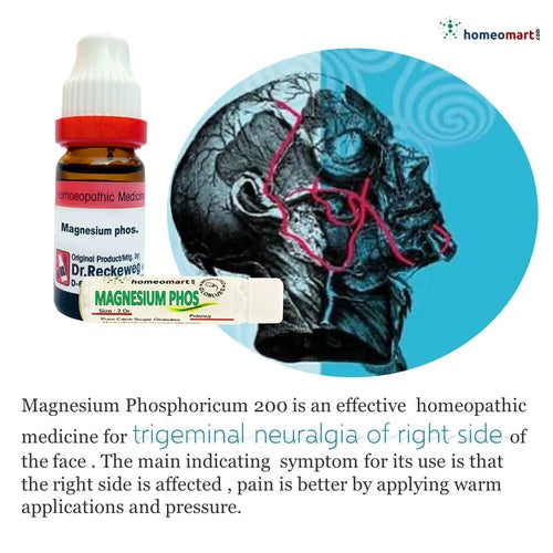 Homeopathic medicine bottle with packaging and a diagram of trigeminal neuralgia on a white background.
