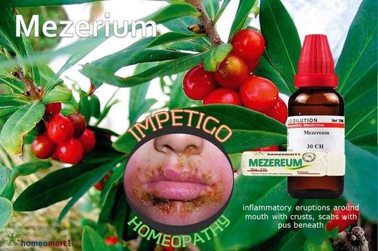 homeopathy Mezereum 30 for Deep redness thick crusts in impetigo