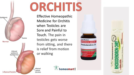 Rhododendron 30 homeopathy medicine for Orchitis Pain radiating to abdomen/thighs, worse on rest