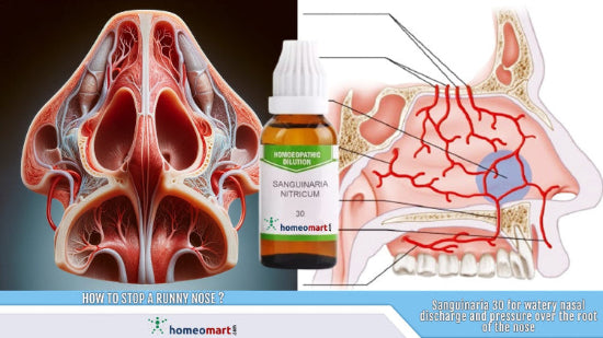 homeopathy for Post-Nasal Drip, Sinusitis, Rhinitis, Throat Infection