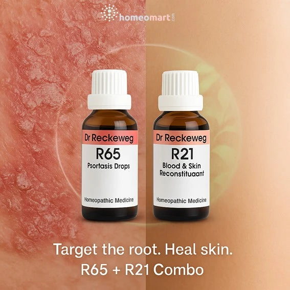 R65 & R21 combo provides a powerful two-step approach to managing chronic skin conditions like psoriasis vulgaris, eczema, and itchy dermatitis.