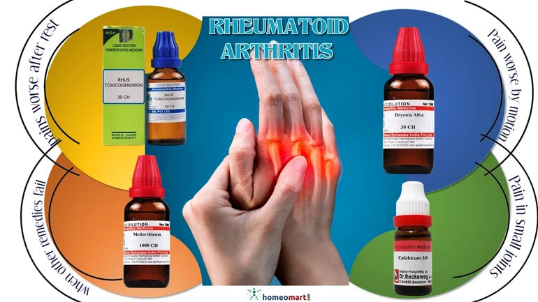 best homeopathy medicines to treat joint pain naturally