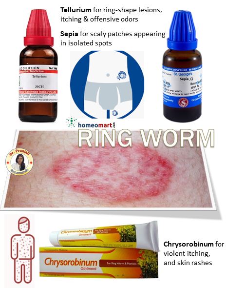 Homeopathic remedies for ringworm with product images and a diagram of ringworm on skin.