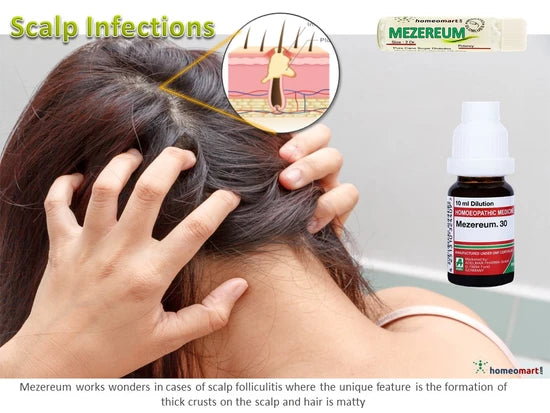 Person with scalp issues and Mezereum bottle on a white background
