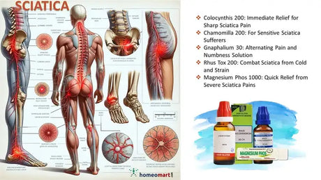 effective safe remedies for Sciatica treatment at home