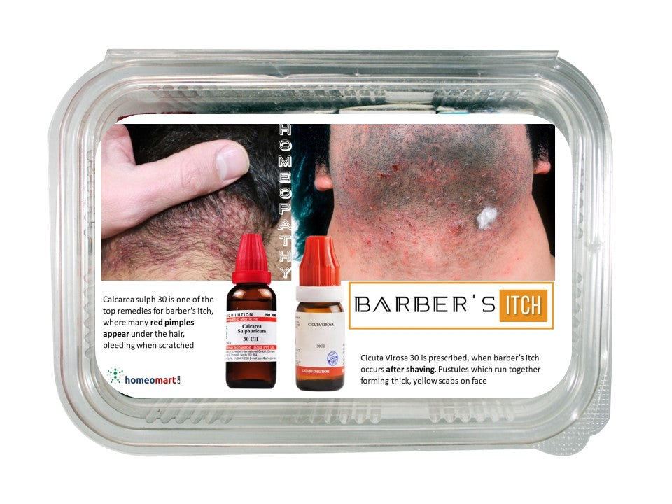 Barber's itch homeopathy medicines