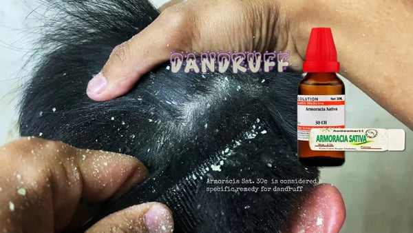 best dandruff treatment in pills and drops for safe natural medication