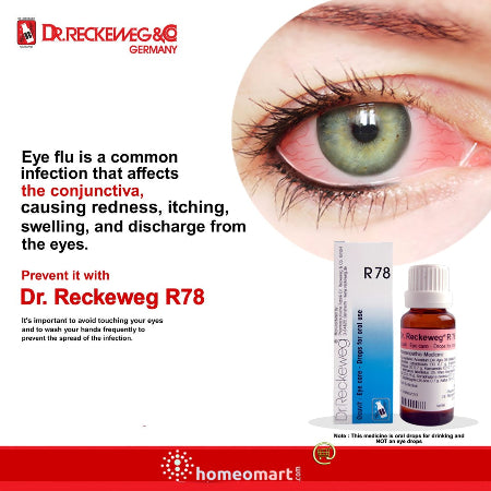 eye flu medicine in drops. homeopathic R78 for pink eye treatment
