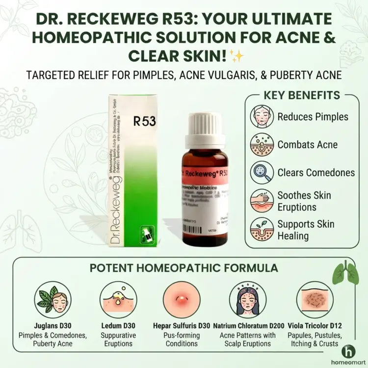 Dr Reckeweg R53 ingredients and uses, Dr Reckeweg, R53, acne, acne vulgaris, pimples, acne pimples, teenage acne, puberty acne, back acne, facial acne, comedones, pustules, papules, suppurative skin, eczema, dermatitis, skin eruptions, homeopathic acne drops, homeopathic skin medicine, Reckeweg remedies, German homeopathy, 22 ml, Juglans, Hepar Sulfuris, Ledum, Viola Tricolor, Natrium Chloratum, acne homeopathy