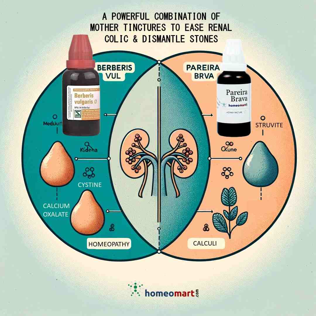 best Kidney stones treatment homeopathic medicines