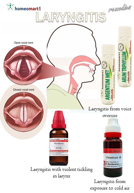 regain your voice quickly naturally and safely with homeopathic remedies