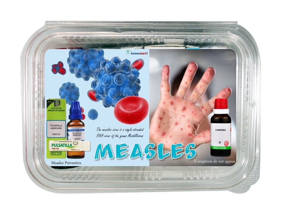  Measles treatment homeopathy medicines