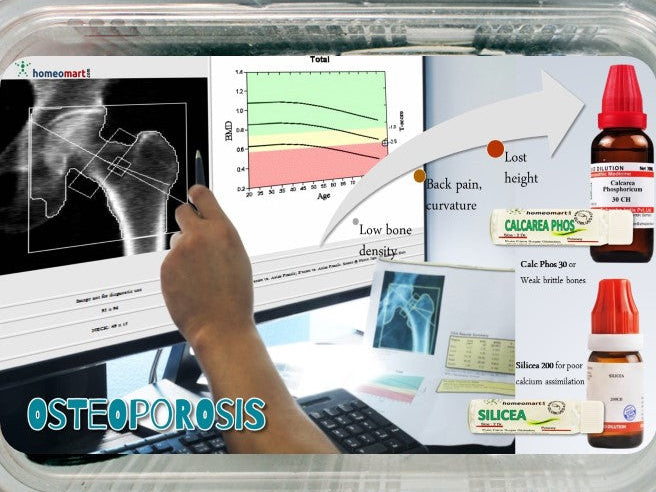 Osteoporosis homeopathic medicines by indications