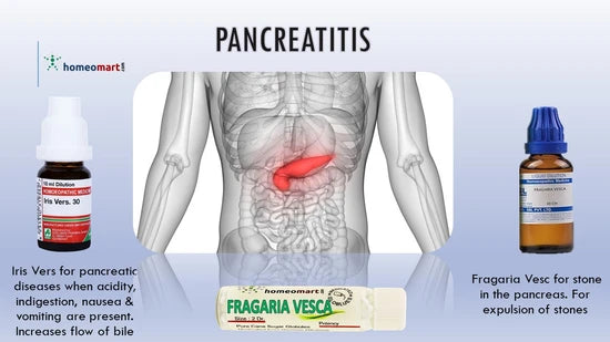 phosphorus homeopathy medicine is indicated for foul greasy stool in pancreatitis