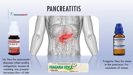 phosphorus homeopathy medicine is indicated for foul greasy stool in pancreatitis