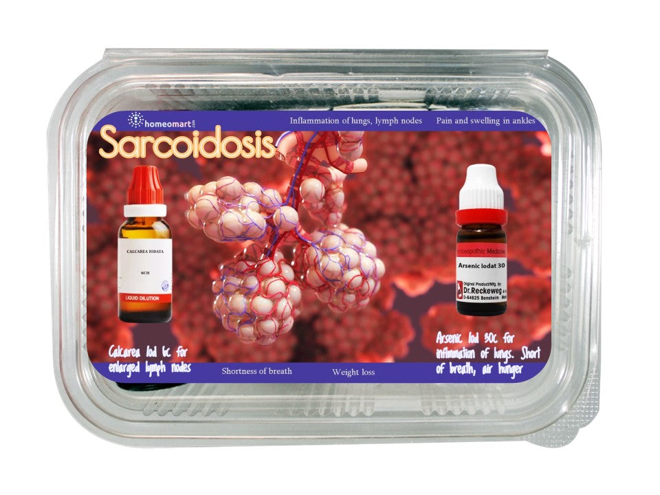 Sarcoidosis treatment Homeopathy Medicines