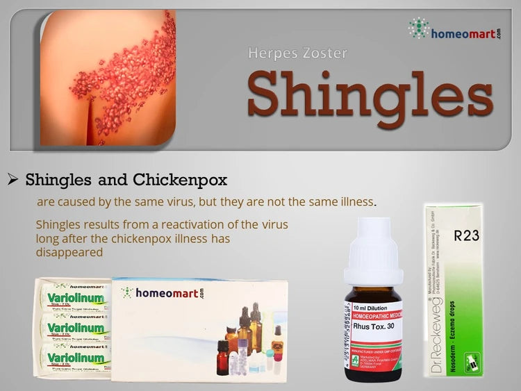 Advertisement for Shingles and Chickenpox with medical products and text on a gray background