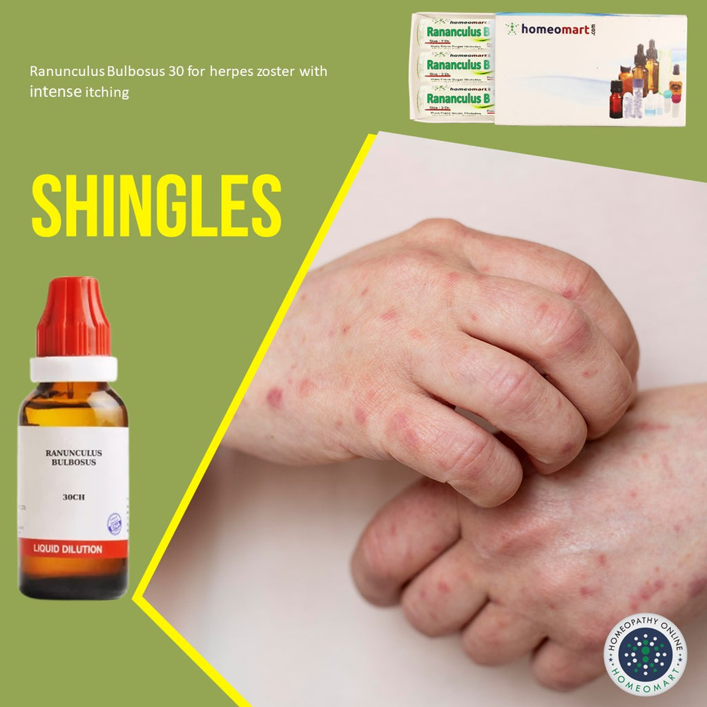 How to recover from shingles quickly with homeopathy