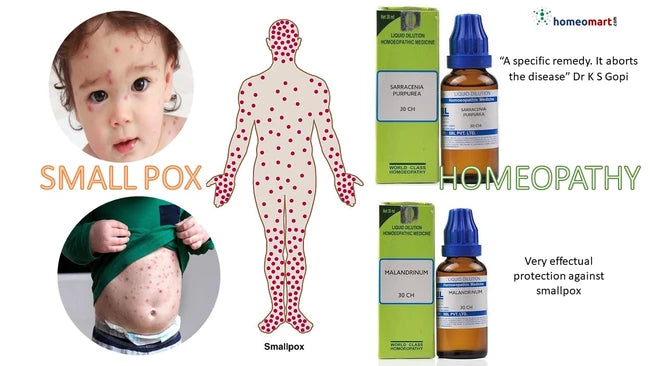 Homeopathy treatment for smallpox with images of a child, body diagram, and homeopathic medicines.