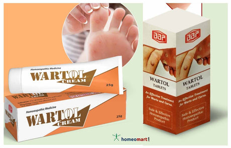 Homeopathy warts tablets and cream