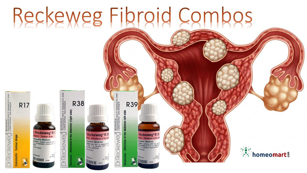 fibroid treatment without surgery