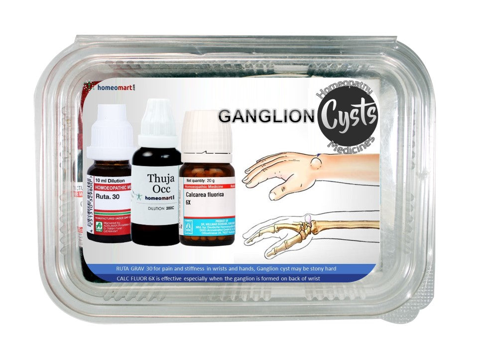 ganglion cyst treatment homeopathy medicines