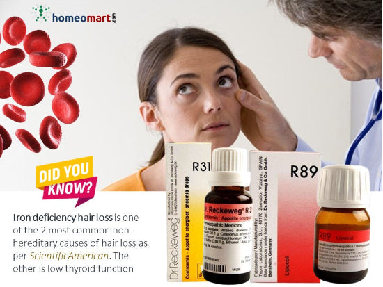 homeopathy for hair loss due to anemia and iron deficiency. Anemia hair loss recovery medicine