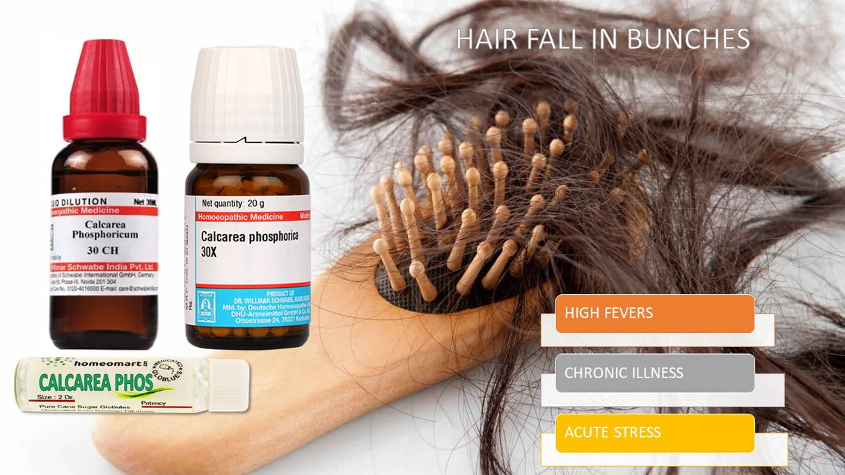 Calcarea Phos 30 homeopathy medicine for losing hair in bunches