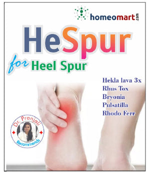 Homeopathy medicines for calcaneal spur treatment (Heel Spur and Plantar Fasciitis Relief )