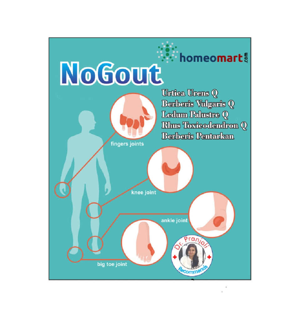 homeopathy treatment of Gout Uric Acid Diathesis
