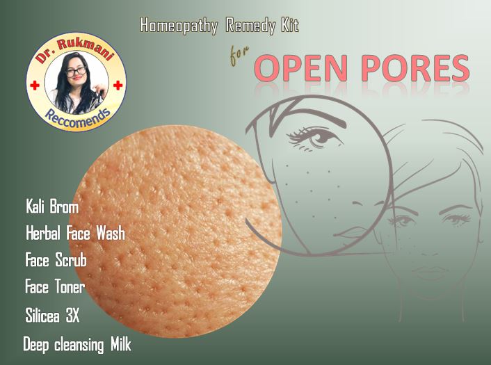 Homeopathy natural medicines for Open pores treatment at home