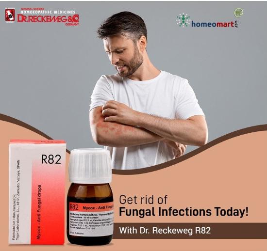 fungal infection treatment at home safe, natural with R82 drops