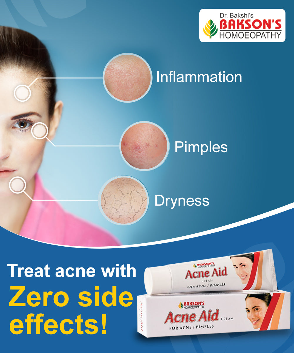 best acne cream , Bakson, Acne Aid, Homeopathic Skincare, Berberis Aquifolium, Thuja, Calendula, Acne Cream, Pimple Treatment, Blemish Control, Acne Scars, Dark Spot Removal, Oil Control, Non-Comedogenic, Hypoallergenic, Natural Face Cream, Skincare 30g