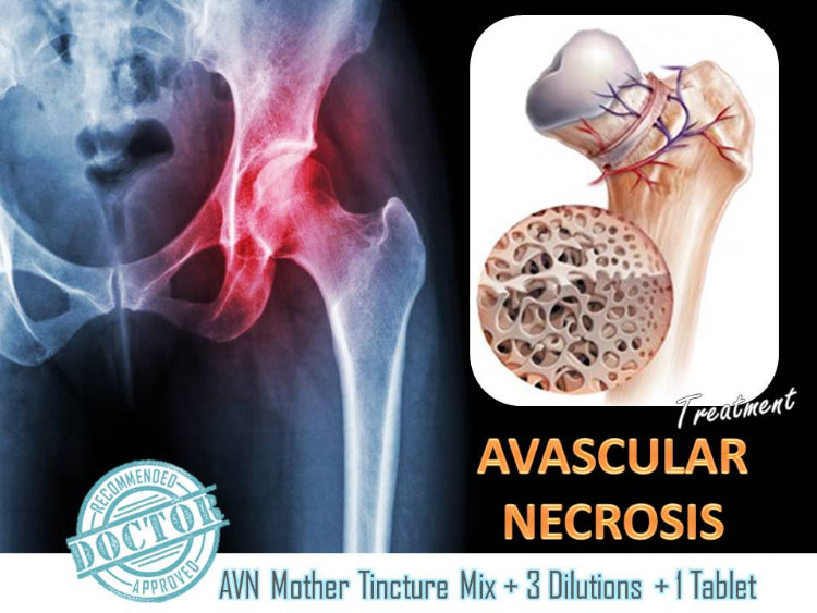 natural cure for avascular necrosis of the hip
