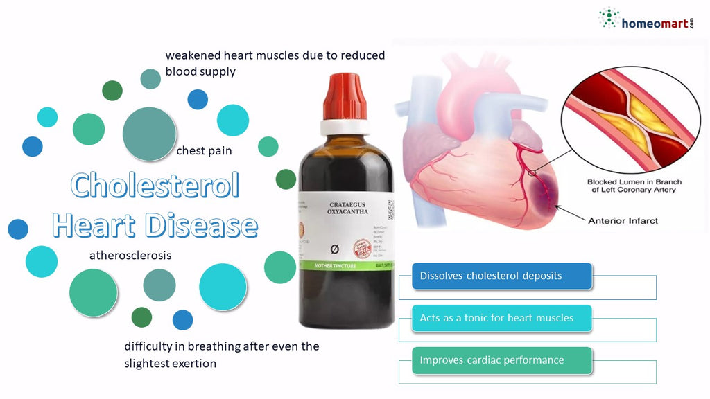 cholesterol and heart disease treatment homeopathy medicine 