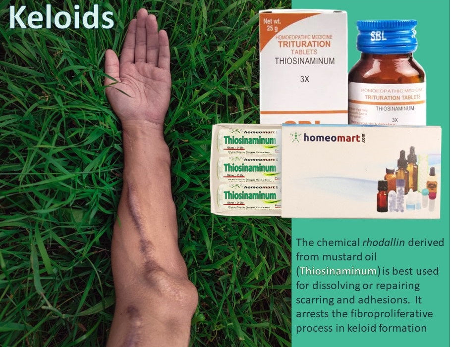 keloid scar treatment in homeopathy, skin healing, wound healing, adhesions, cicatrix, homeopathy for scars, treatment for hypertrophic scars naturally, homeopathic medicine for scar tissue reduction