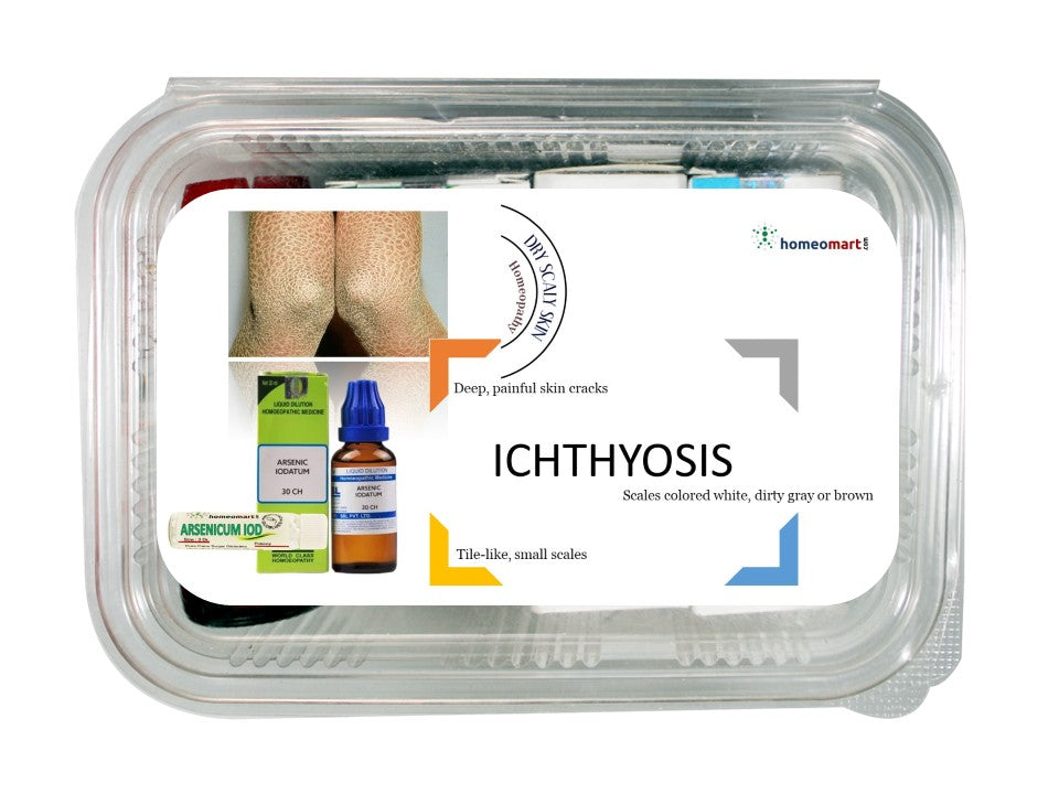 Ichthyosis treatment homeopathic medicines