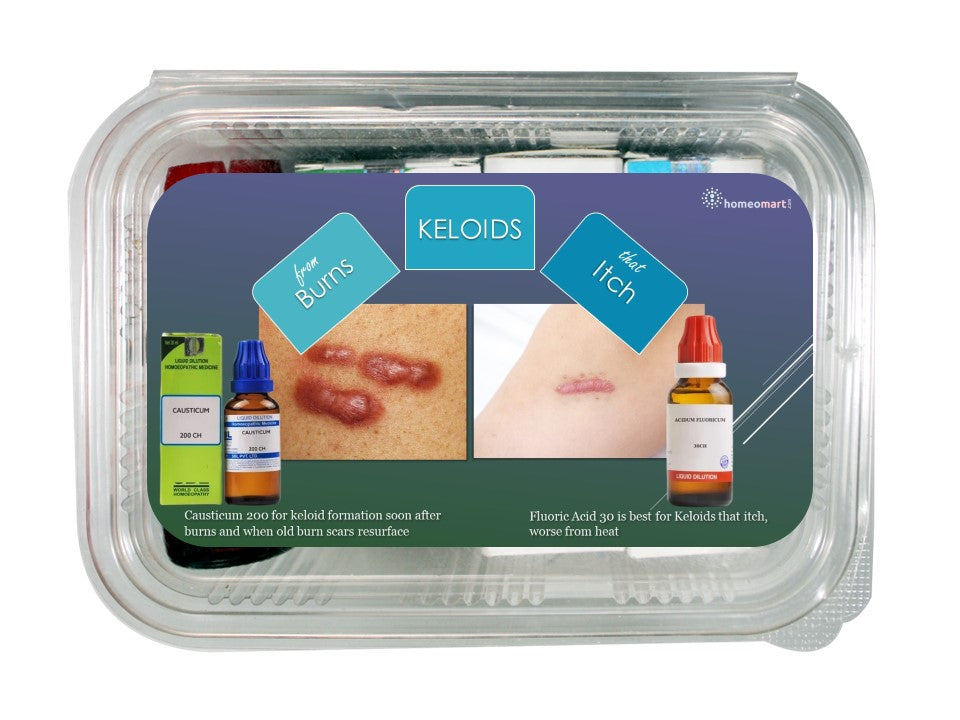 Keloid scar removal homeopathy medicines