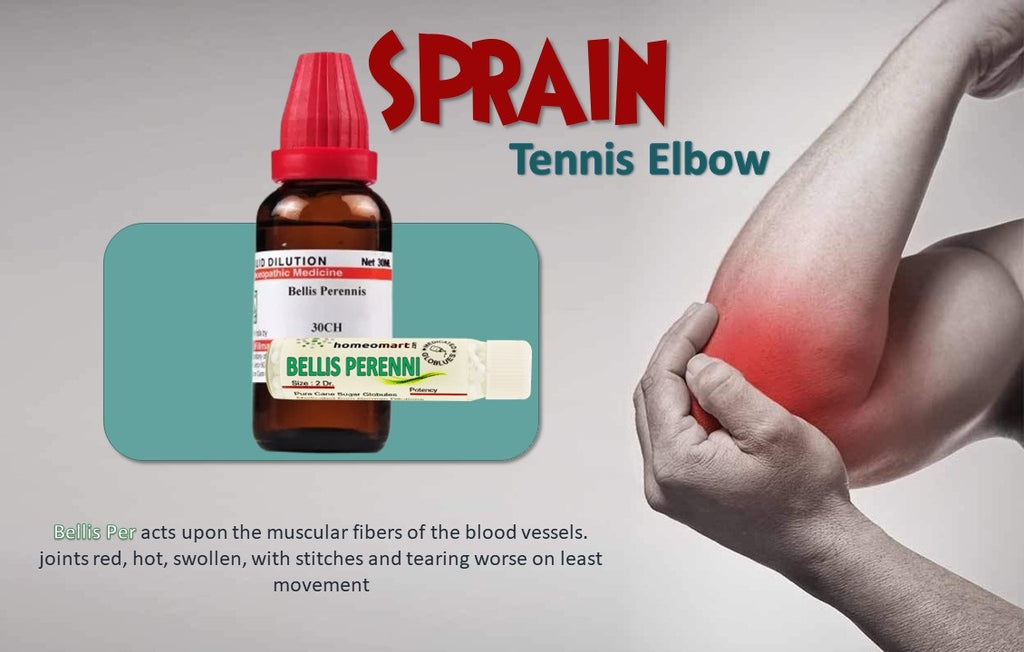 tennis elbow treatment homeopathic
