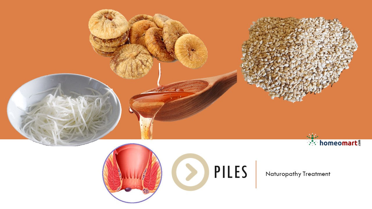 Piles Treatment at Home - Try these natural remedies